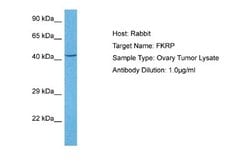 FKRP Antibody, Novus Biologicals 100 &mu;L; Unconjugated:Antibodies, Polyclonal